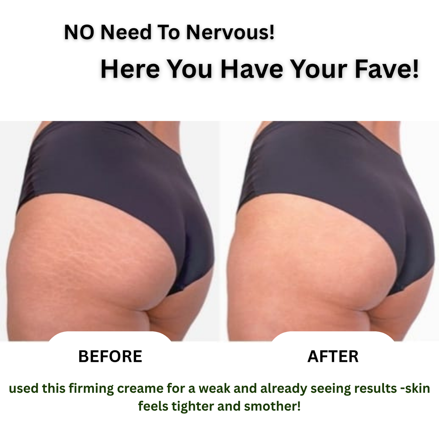 Firming Butter Thigh Body Cream 50gm( Pack of 2)